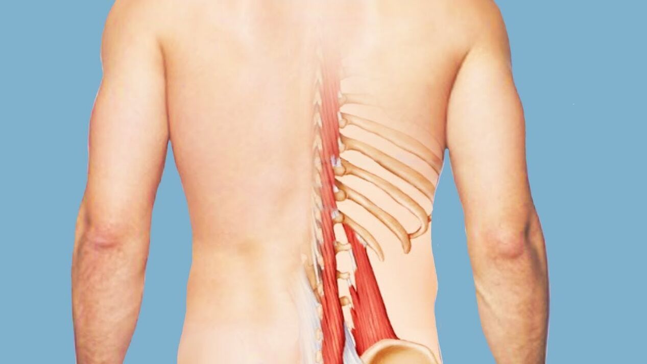 viêm cơ là nguyên nhân gây đau lưng